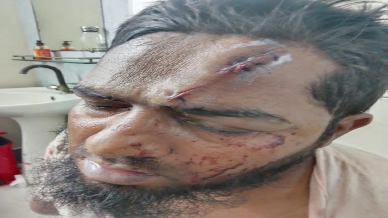 চট্টগ্রামের আনোয়ারায় হাতুড়ির আঘাতে গুরুতর আহত প্রতিবন্ধী যুবক